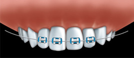 South Family Dental | South Calgary Orthodontics | Calgary Orthodontist