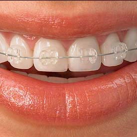 SE Calgary Orthodontic Dentistry