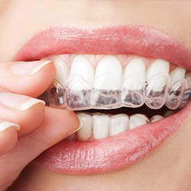 SE Calgary Orthodontic Dentistry