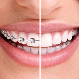 SE Calgary Orthodontic Dentistry